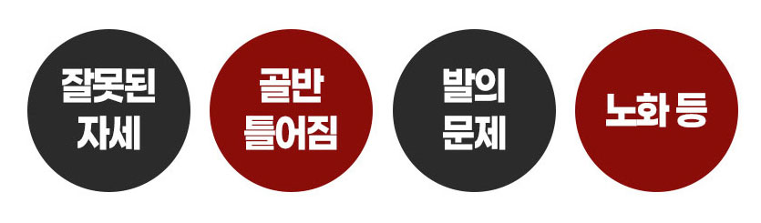 후천적 평발 원인 잘못된 자세 골반 노화 인포그래픽